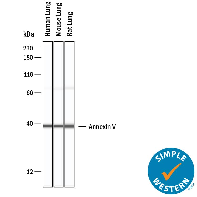 Simple Western lane view shows lysates of Human lung, mouse lung, rat lung, loaded at 0.2 mg/mL. A specific band was detected for Annexin V at approximately 38 kDa (as indicated) using 12.5 µg/mL of Goat Anti-Human/Mouse/Rat Annexin V Antigen Affinity-purified Polyclonal Antibody (Catalog # AF399) . This experiment was conducted under reducing conditions and using the 12-230 kDa separation system.