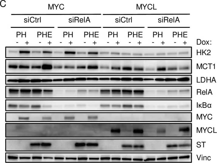 Differential effects of MYC and NF-kappa B on glycolytic gene and MCT1 levels.A) Promoter region of MCT1 includes MYC and NF-kappa B binding sites. Shading reflects four independent IMR90 DNase I hypersensitivity datasets. B) IMR90 cells stably expressing ST, GFP or p53DD + hTERT (PH) and MCPyV tumor-derived early-region (PHE) with inducible expression of MYC, MYCN or MYCL were treated with dox (+) for 48 hours. Lysates were immunoblotted with the indicated antibodies. C) IMR90 PH and PHE cells inducibly expressing MYC or MYCL were transfected with RelA-specific pooled siRNA (siRelA) or non-targeting siRNA (siCtrl). After 24 hours, cells were refed with dox containing media and lysed after an additional 48 hours. Image collected and cropped by CiteAb from the following publication (//dx.plos.org/10.1371/journal.ppat.1006020), licensed under a CC-BY license. Not internally tested by R&D Systems.