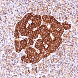 Immunohistochemistry ICA1 Antibody [Unconjugated]