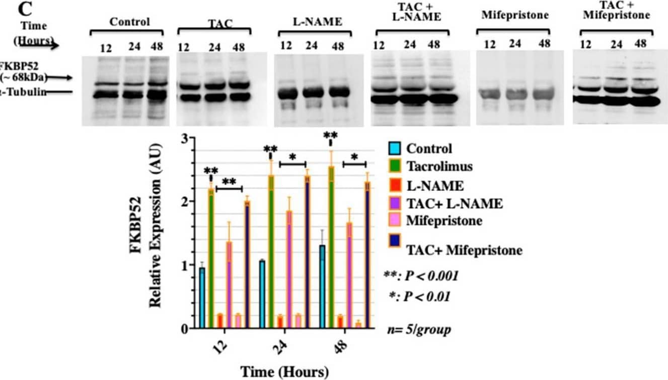 Effect of low-dose tacrolimus, L-NAME or mifepristone and their combination formulations on the levels of expression and cellular localization of FKBP52 and PGR in HTR-8/SVneo cells. (A) Representative confocal fluorescent microscope images of monolayers of confluent HTR-8/SVneo cells treated for 24 h with low-dose tacrolimus (10 ng/mL), L-NAME or a combination of both. Cells were stained with antibodies to PGR (red channel) and FKBP52 (green channel) and cell images were captured and analyzed for their fluorescent intensity using Quorum Wave Effects Spinning disc confocal microscope. Nuclei were counterstained with DAPI (blue channel) and the colocalization of PGR and FKBP52 appears as yellow on the overlay images. (B) Histogram depicting differences in the intensity of colocalization of PGR and FKBP52 (yellow channel) showing significant effect of low-dose tacrolimus on the expression of the PGR-FKBP52 complex in treated HTR-8/SVneo cells. (C) Representative WB images and associated histograms of the expression levels of FKBP52 protein in the tacrolimus- and L-NAME-treated HTR-8/SVneo cells. Note the statistically significant effects (p < 0.001) of tacrolimus in antagonizing the suppressive actions of L-NAME and those of mifepristone on the protein expression of FKBP52 in the HTR-8/SVneo cells. Data in (B,C) are represented as the mean with error bars representing S.D. Scale bars in A = 15 μm. Mifepristone was used to determine the mode of action of tacrolimus in potentiating the PGR signaling in HTR-8/SVneo cells. Image collected and cropped by CiteAb from the following open publication (//pubmed.ncbi.nlm.nih.gov/35955565), licensed under a CC-BY license. Not internally tested by R&D Systems.