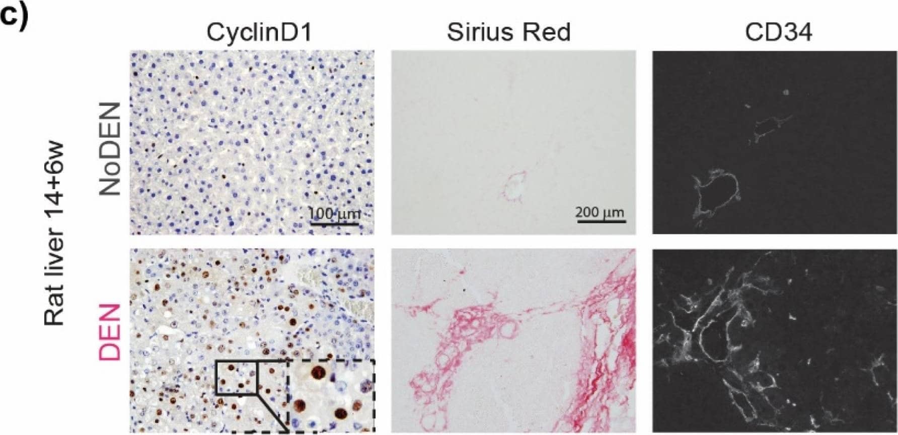Chronic DEN-induced hepatocarcinogenesis is associated with hypoxia. (a) Timeline protocol of the DEN-induced cirrhotic rat model of HCC. Seven-week-old Fisher 344 rats were injected weekly by DEN (50 mg/kg per week); 8 w indicates 8 weeks of DEN injections, 14 w indicates 14 weeks of DEN injections, and 14 + 6 w indicates 14 weeks of DEN injections followed by 6 weeks of no DEN injections. The arrows indicate the day of tissue harvest. (b) Representative pictures of the liver at 14 + 6 w from the rat without DEN treatment (upper panel) and the rat chronically treated with DEN (lower panel). (c) Representative images of the liver from rats untreated (upper panels) or treated with DEN injections (as above, lower panels). Histopathological sections stained with nuclear Cyclin D1 (20× magnification, left panels), with Sirius red (middle panels), and with anti-CD34 immunofluorescence (right panels). (d) Heatmap showing the single-sample Gene Set Enrichment Analysis (GSEA) scores for the Hypoxia Hallmarks gene set. (e–g) GSEA plots of differentially expressed genes from livers of DEN-treated versus untreated (NoDEN) rats at 14 weeks ((e): non-tumor tissue) and 14 + 6 weeks ((f): non-tumor tissue, (g): tumor tissue), showing the enrichment of genes associated with the response to low oxygen levels (Hypoxia-Hallmarks). NES, normalized enrichment score; FDR, false discovery rate; w, weeks. Image collected and cropped by CiteAb from the following open publication (//pubmed.ncbi.nlm.nih.gov/35805134), licensed under a CC-BY license. Not internally tested by R&D Systems.