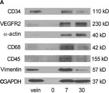 Western Blot CD34 Antibody [Unconjugated]