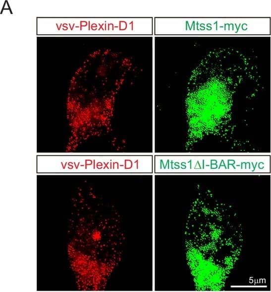 In cultured medium spiny neurons (MSNs), Mtss1 expression is directly regulated by Sema3E-Plexin-D1 signaling through the AKT pathway.(A) WB images showing Mtss1 expression in MSNs derived from the striatum of wild-type (WT) or Plxnd1 conditional knockout (cKO) mice at P0 & measured at DIV3 & DIV6 in culture. (B) Quantification of band intensity in (A). Two-way ANOVA with Tukey’s post hoc correction for multiple comparisons; n = 3. (C) Mtss1 expression in MSNs obtained from the striatum of WT or Sema3e KO mice at P0 & measured at DIV6 in culture. (D) Quantification of the blots shown in (C). Student’s t-test; n = 5 for WT, n = 5 for KO in five independent experiments. (E) Schematic illustration of the experimental strategy for Sema3E-ligand or MK2206, an AKT inhibitor treatment in MSN culture. (F, G) WB images showing Mtss1 expression after AP-Sema3E (2 nM) treatment in cultured MSNs derived from Sema3e KO mice or Plxnd1 cKO mice. (H, I) Quantification of (F, G). Student’s t-test; AP, n = 4, AP-sema3E, n = 4 for sema3e KO mice, AP n = 4, AP-sema3E n = 4 for Plxnd1 cKO mice in three independent experiments. (J, K) WB to analyze the expression of Mtss1 & Plexin-D1 after MK2206 (100 nM) treatment in cultured MSNs & subsequent quantification for band intensity (L, M). Student’s t-test; n = 6 for sham, n = 6 for MK2206 in six independent experiments. (N O) WB image & analysis showing Mtss1 expression in Sema3e knockout MSNs treated with MK2206 after incubation with AP-Sema3E. Two-way ANOVA with Tukey’s post hoc correction for multiple comparisons; n = 5 in five independent experiments. Error bars, mean ± SEM; *p0.05 by two-way ANOVA with Tukey’s post hoc correction for multiple comparisons; vsv-Plexin-D1+Mtss1 myc, n = 5, and vsv-Plexin-D1+Mtss1 delta I-BAR-myc, n = 5. Scale bar, 5 μm. Image collected and cropped by CiteAb from the following open publication (//elifesciences.org/articles/96891), licensed under a CC-BY license. Not internally tested by R&D Systems.