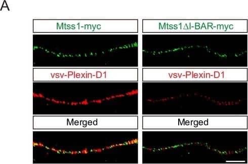 Mtss1 facilitates Plexin-D1 transport to the growth cone in cultured Drd1a-positive medium spiny neurons (MSNs).(A) Immunocytochemistry for Mtss1-myc or Mtss1 delta I-BAR -myc (green), vsv-Plexin-D1 (red) in the axons of MSNs transfected with vsv-Plexin-D1 and Mtss1-myc or Mtss1 delta I-BAR-myc, using Mtss1-null mice as a background. The images were acquired using structured illumination microscopy (N-SIM). Scale bar, 5 μm. Image collected and cropped by CiteAb from the following open publication (//elifesciences.org/articles/96891), licensed under a CC-BY license. Not internally tested by R&D Systems.
