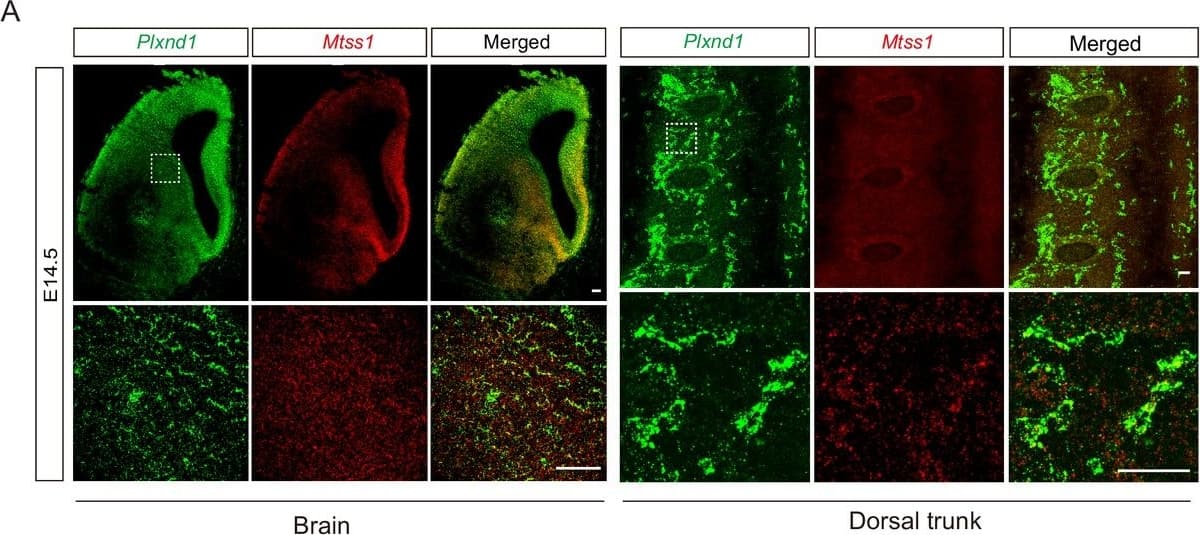 The absence of Mtss1 does not affect medium spiny neuron (MSN) survival, dendritic arborization, and Plexin-D1 expression during striatonigral pathway development.(A) Immunohistochemistry staining for cleaved caspase 3 (CC3) in the striatum of wild-type (WT) or Mtss1 conditional knockout (cKO) mice. The white dotted boxes on the left images are shown in the inset images on the right at a better resolution. Scale bar, 25 μm. (B) Quantification of cell death by the number of CC3-positive cells in a 1 mm2 area covering the dorsal part of the striatum in WT or Mtss1 cKO mice. Error bars, mean ± SEM; ns p>0.05 by Mann‒Whitney test; WT, n = 20; Mtss1 cKO mice, n = 20 (five sections/mouse). (C) Representative images of Golgi staining at low (top panels) and high (bottom panels) magnification. Scale bars, 100 μm. Sholl analysis of dendritic morphology (D) and dendritic length (E) performed by using Neurolucida360 in 3D analysis. Error bars, mean ± SEM; ns p>0.05 by Student’s t-test; WT, n = 12, and Mtss1 cKO mice, n = 15, from three mice. (F, G) Western blot images and quantification of Plexin-D1 expression in the striatum of WT or Mtss1 cKO mice at P5. Error bars, mean ± SEM; *p0.05 by Mann‒Whitney test; WT, n = 20; Mtss1 cKO mice, n = 20 (five sections/mouse). (C) Representative images of Golgi staining at low (top panels) and high (bottom panels) magnification. Scale bars, 100 μm. Sholl analysis of dendritic morphology (D) and dendritic length (E) performed by using Neurolucida360 in 3D analysis. Error bars, mean ± SEM; ns p>0.05 by Student’s t-test; WT, n = 12, and Mtss1 cKO mice, n = 15, from three mice. (F, G) Western blot images and quantification of Plexin-D1 expression in the striatum of WT or Mtss1 cKO mice at P5. Error bars, mean ± SEM; *p0.05 by Mann‒Whitney test; AP, n = 4, AP-Sema3E, n = 4 for HUVECs, ns p>0.05 by Student’s t-test; AP, n = 4, AP-Sema3E, n = 4 for HCMEC/D3s in four dependent experiments. Figure 8—figure supplement 1—source data 1.Western blots shown in Figure 8—figure supplement 1C.Western blots shown in Figure 8—figure supplement 1C. Image collected and cropped by CiteAb from the following open publication (//elifesciences.org/articles/96891), licensed under a CC-BY license. Not internally tested by R&D Systems.