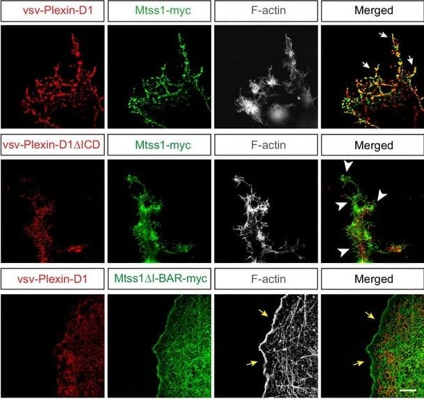 Mtss1 expression alters Plexin-D1 localization to the protrusion structure in COS7 cells without affecting its endocytosis or Sema3E binding. (F) Immunocytochemistry for vsv-Plexin-D1 (red), Mtss1-myc (green), and F-actin (gray) in COS7 cells. Images were obtained by structured illumination microscopy (N-SIM). White arrows (top) indicate colocalized Plexin-D1 and Mtss1 in the protrusion structure. White arrowheads (middle) indicate high Mtss1 levels localized in cell protrusions without Plexin-D1. Yellow arrows (bottom) indicate the normal cell surface with Mtss1 delta I-BAR but no Plexin-D1 colocalization. Scale bar, 5 μm. Image collected and cropped by CiteAb from the following open publication (//elifesciences.org/articles/96891), licensed under a CC-BY license. Not internally tested by R&D Systems.