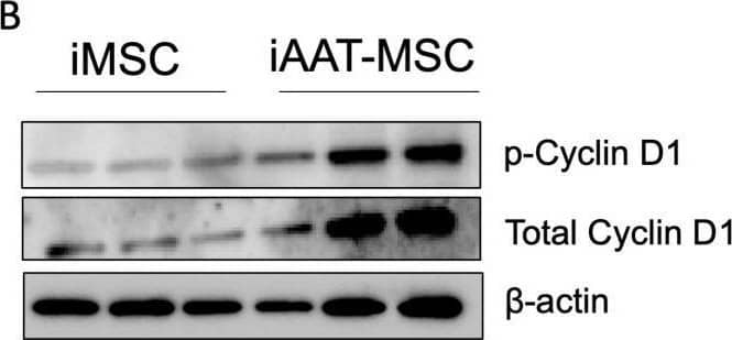Cyclin D1 mRNA and protein expression in iAAT-MSCs and iMSCs. (A). Cyclin D1 mRNA expression was higher in iAAT-MSCs compared to iMSCs; data are fold changes compared to GAPDH expression in each sample. (B) Expression of Cyclin D1 and phosphorylated (p)-Cyclin D1 and  beta -actin in iMSCs and iAAT-MSC. Lanes 1–3 are iMSCs in triplicate and 4–6 are iAAT-MSCs in triplicate. (C,D). Quantification/relative expression of CyclinD1/ beta -actin and p-Cyclin D1/ beta -actin, p-Cyclin D1/total Cyclin D1 at the protein level (C) and ratios (D) in iAAT-MSCs compared to iMSCs. (E) Representative expression of Cyclin D1 stained from cell culture of iMSCs and iAAT-MSCs. Red signals identify Cyclin D and blue staining structures are nuclei. Scale bar = 40 μm. * p < 0.05, Student’s t-test. NS: not significant. Image collected and cropped by CiteAb from the following open publication (//pubmed.ncbi.nlm.nih.gov/38396691), licensed under a CC-BY license. Not internally tested by R&D Systems.