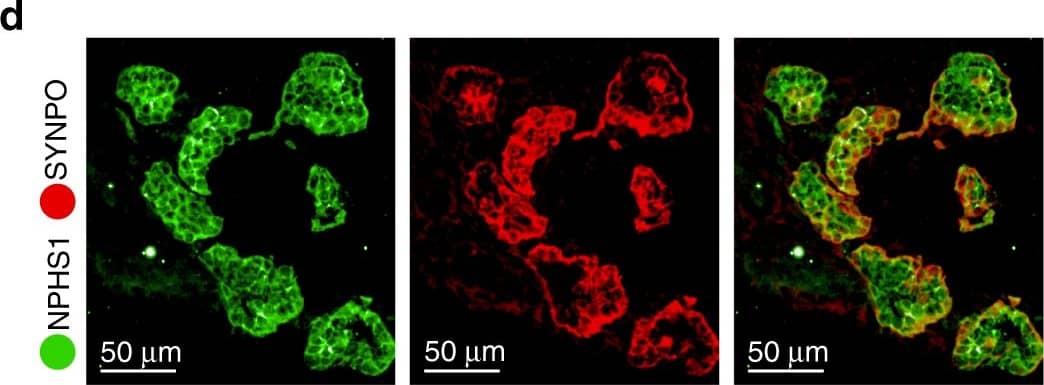 IF validation of markers derived from the single-cell data in mature kidney organoids. a IF staining of an entire kidney organoid with segment specific markers as shown. b Schematic of kidney nephron with major cell types and canonical markers annotated. c Immunofluorescence staining of D29 kidney organoids for podocyte (WT1), proximal tubule (LTL), and distal tubule (CDH1 and GATA3) across two protocols (JB, ML) and four cell lines (AS, N1, N2, ThF). IF staining for validation of markers identified in the single-cell data: d NPHS1 colocalized with the podocyte-specific marker SYNPO and e LRP2 colocalized with the proximal tubular marker LTL (bottom). f IF staining validation for MEIS1-positive mesenchymal cells in D29 organoids. LAMA1 indicates basement membranes. MEIS1 staining of mesenchymal cells appropriately surrounds LAMA1-defined tubular nephron structures. Image collected and cropped by CiteAb from the following publication (//pubmed.ncbi.nlm.nih.gov/31784515), licensed under a CC-BY license. Not internally tested by R&D Systems.