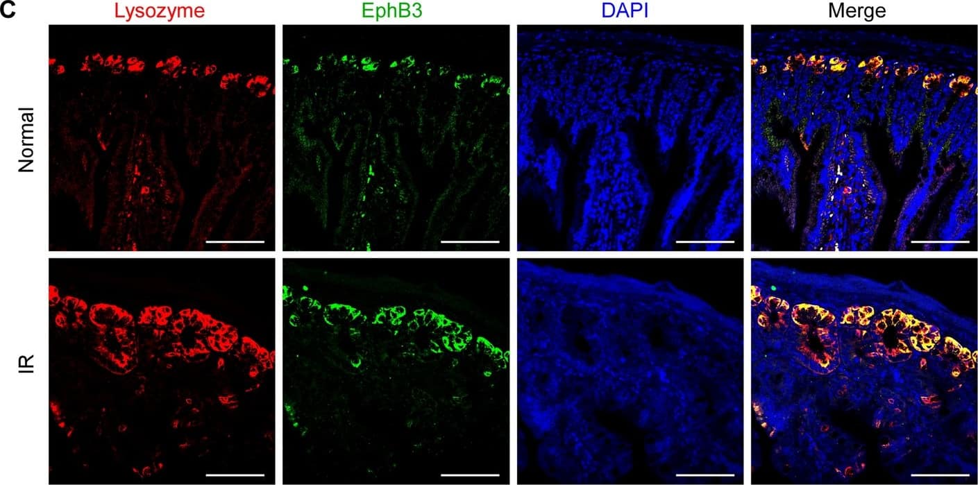 Immunohistochemistry EphB3 Antibody [Unconjugated]