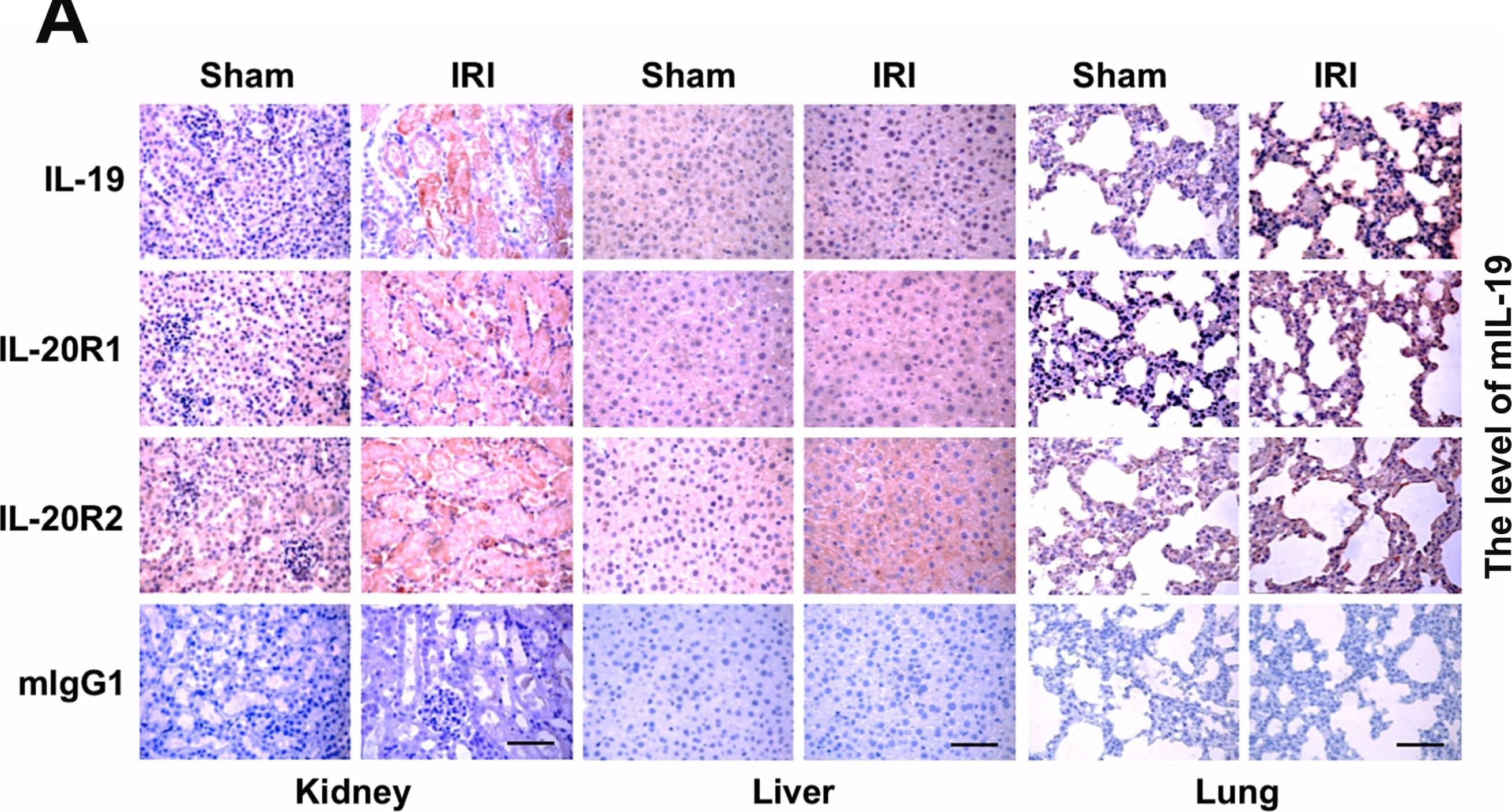 Expression of IL-19 and its receptors in three vital organs of ischemic AKI mice.(A) AKI mice (n = 5 in each group) were killed 48 h after renal IRI. Paraffined sections of kidney, liver, and lung tissue were stained using anti-IL-19 mAb, anti-IL-20R1 mAb, and anti-IL-20R2 polyclonal Ab. Anti-mIgG1 was a negative control. The reaction was detected using AEC chromogen stain (red), and the nuclei were counterstained with hematoxylin (blue). The bars represent 50 µm. All five mice in each group showed similar patterns. Shown sections are representative of five individual mice. (B) Mouse tissues of each group (n = 5) were isolated and homogenized to extract total protein. Mouse IL-19 expression in kidney, liver, and lung were analyzed using direct ELISA. *P<0.05 compared with sham-operated mice. (C–E) Experimental mice were killed 2 days after renal IRI. RTQ-PCR was done with primers specific for IL-19, IL-20R1, and IL-20R2. The relative quantification of PCR products was expressed as 2− delta  delta Ct, corrected using GAPDH expression, and relative to levels of untreated cells. Data are the means ± SD of three experiments. *P<0.05 compared with sham-operated mice. Image collected and cropped by CiteAb from the following publication (//dx.plos.org/10.1371/journal.pone.0056028), licensed under a CC-BY license. Not internally tested by R&D Systems.