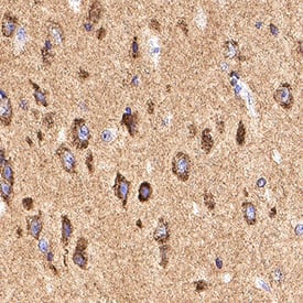 Immunohistochemistry Neuronal Pentraxin R/NPTXR Antibody [Unconjugated]