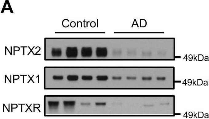 NPTX levels are reduced in CSF from individuals with clinically diagnosed AD.(A,B) Western blot assays of NPTX2, NPTX1 and NPTXR in lumbar cerebrospinal fluid (CSF) from age-matched controls and patients with clinically diagnosed AD. AD patients show reduced NPTX2, NPTX1 and NPTXR levels in CSF. Control, n = 36; AD, n = 30. Image collected and cropped by CiteAb from the following open publication (//pubmed.ncbi.nlm.nih.gov/28440221), licensed under a CC-BY license. Not internally tested by R&D Systems.