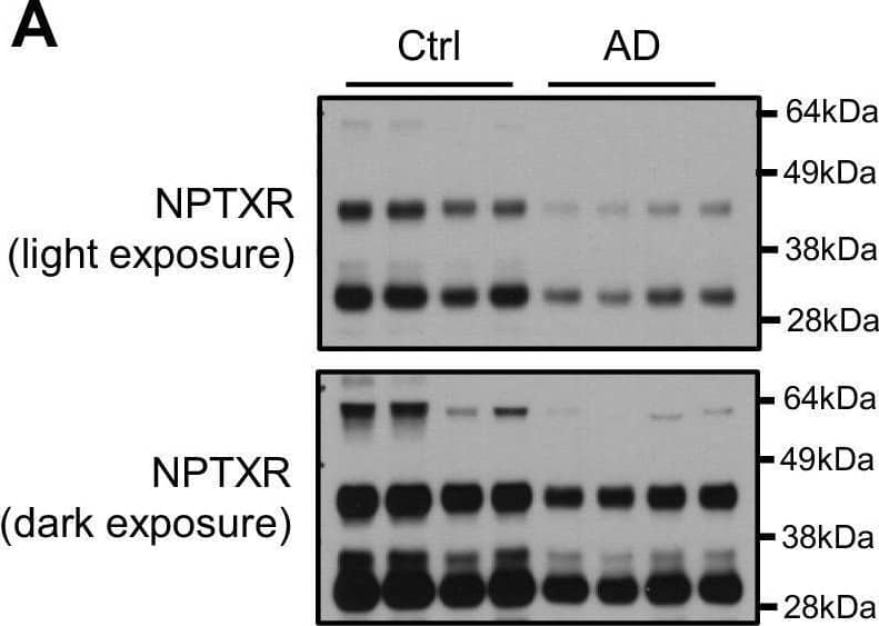 Reduction of NPTXR levels in lumbar cerebrospinal fluid (CSF) from individuals with AD.(A) Representative western blot images show three major bands with human CSF samples by NPTXR antibody. (B) Patients with clinically diagnosed AD have reduced NPTXR levels in CSF compared with healthy controls. Control, n = 31; AD, n = 28. ***p<0.001 by two-tailed t test. Data represent mean ± SEM.DOI://dx.doi.org/10.7554/eLife.23798.019 Image collected and cropped by CiteAb from the following open publication (//pubmed.ncbi.nlm.nih.gov/28440221), licensed under a CC-BY license. Not internally tested by R&D Systems.
