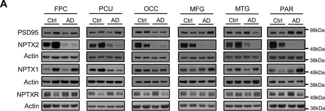 NPTX2 levels are reduced in human postmortem AD brain and DS brain, but not in ASYMAD brain. Representative western blot images (A) of NPTX2, NPTX1, and NPTXR, normalized to PSD95 in the frontopolar cortex (FPC), precuneus (PCU), occipital gyrus (OCC), middle frontal gyrus (MFG), middle temporal gyrus (MTG) and parietal gyrus (PAR) from controls and AD subjects. NPTX2 is down-regulated in all assayed brain regions of AD individuals. FPC: control, n = 7; AD, n = 8. PCU: control, n = 15; AD, n = 19. OCC: control, n = 7; AD, n = 7. MFG: control, n = 9; AD, n = 16. MTG: control, n = 10; AD, n = 18. PAR: control, n = 5; AD, n = 5. (C) Nptx2 mRNA is reduced in AD brain. FPC: control, n = 9; AD, n = 16. PCU: control, n = 7; AD, n = 6. Image collected and cropped by CiteAb from the following open publication (//pubmed.ncbi.nlm.nih.gov/28440221), licensed under a CC-BY license. Not internally tested by R&D Systems.