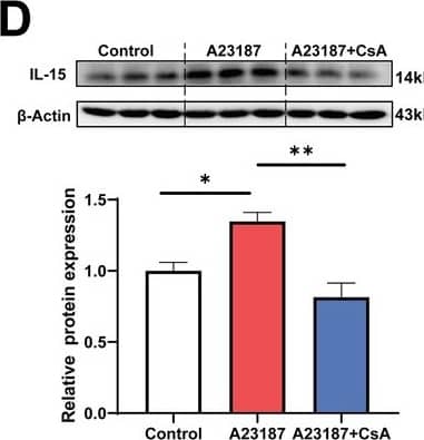 Western Blot IL-15 Antibody [Unconjugated]