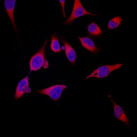 S100A8 was detected in immersion fixed HeLa human cervical epithelial carcinoma cell line using Sheep Anti-Human S100A8 Antigen Affinity-purified Polyclonal Antibody (Catalog # AF4570) at 10 µg/mL for 3 hours at room temperature. Cells were stained using the NorthernLights™ 557-conjugated Anti-Sheep IgG Secondary Antibody (red; <a class=