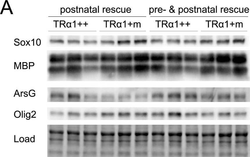 Western Blot Arylsulfatase G/ARSG Antibody