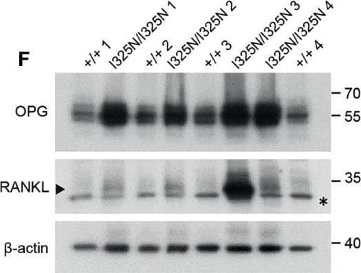 Western Blot TRANCE/TNFSF11/RANK L Antibody [Unconjugated]