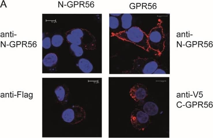 TG2 treatment of GPR56 or N-GPR56-expressing cells does not result in detectable intermolecular crosslinking of the N-terminal GPR56 domain. (A) Optical section acquired by Confocal microscopy showing N-GPR56 and GPR56 expression in transfected cells under non permeabilising conditions (Top panel: anti N-GPR56 antibody with GPR56 signals in red) and permeabilising conditions (Bottom panel: anti Flag antibody for N-GPR56-expressing cells and anti-V5 antibody for GPR56-expressing cells shown in red). Scale bar 10 µm. (B,C) Western blot analysis of cell lysate from AP-AR shedding experiments represented in Figure 3D stained for the N-terminal GPR56 domain and a GAPDH loading control (B) or the V5 epitope tag recognizing C-terminal GPR56 (C). Note that N-GPR56 is not recognized by the V5 antibody. (D) Detection of C-terminal GPR56 fragments required that samples were incubated in SDS sample buffer without heat treatment to avoid loss through aggregation/precipitation. (E,F) Western blot analysis of conditioned medium from AP-AR shedding experiment represented in Figure 3D stained with anti-N-GPR56 antibody or CUB7402 anti-TG2 antibody. Non-specific bands in medium are indicated by asterisks. Image collected and cropped by CiteAb from the following open publication (//www.mdpi.com/1422-0067/25/4/2329), licensed under a CC-BY license. Not internally tested by R&D Systems.
