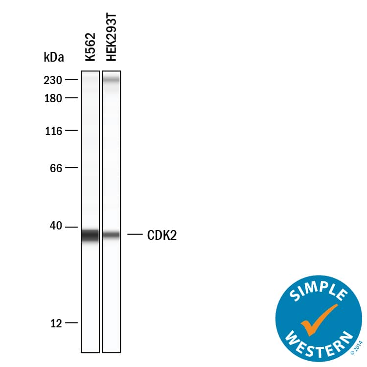 LPS suppressed EPCs cell viability via inducing cell pyroptosis. (a, b) NLRP3 was silenced in EPCs cells. (c) MTT assay was used to examine cell viability. (d) The expression status of Cyclin D1 and CDK2 were determined by Western blot analysis. Individual experiment repeated 3 times, and *P TM.