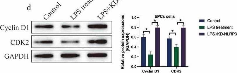 LPS suppressed EPCs cell viability via inducing cell pyroptosis. (a, b) NLRP3 was silenced in EPCs cells. (c) MTT assay was used to examine cell viability. (d) The expression status of Cyclin D1 and CDK2 were determined by Western blot analysis. Individual experiment repeated 3 times, and *P < 0.05 Image collected and cropped by CiteAb from the following open publication (//pubmed.ncbi.nlm.nih.gov/34738867), licensed under a CC-BY license. Not internally tested by R&D Systems.