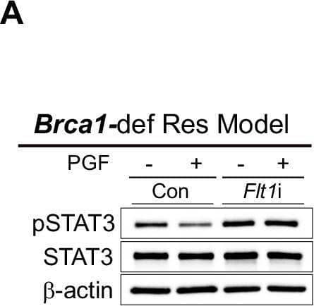 Quantitation of phosphorylated STAT3 (pSTAT3) levels in Brca1-def and Bard1-def breast tumor cells and tumor tissue sections.(A, B) Immunoblot analysis was performed using antibodies against pSTAT3, STAT3 and  beta -actin (loading control) using lysates from Flt1-expressing (Con) and -deficient (Flt1i), talazoparib-resistant (“Res”) Brca1 and Bard1-def tumor cells, treated with 50 ng/mL of mouse PGF protein that were used in Fig. 5A, B. (C) Representative images of IHC for pSTAT3 staining in tumor sections from the mice described in Fig. 1 comparing talazoparib-sensitive (“Sen”) tumors to talazoparib-resistant (“Res”) tumors. Scale bars, 20 µm. (D) Immunostained sections from (C) were quantified using automated QuPath software to identify positively stained cells. For the Brca1-def model, n = 4 tumors for both Sen and Res. For the Bard1-def model, n = 5 Sen tumors, and n = 4 Res tumors. Data were presented as mean values ± SEM. P values were determined by a two-tailed, unpaired, Mann–Whitney test. ns; not significant. Image collected and cropped by CiteAb from the following open publication (//pubmed.ncbi.nlm.nih.gov/38956205), licensed under a CC-BY license. Not internally tested by R&D Systems.