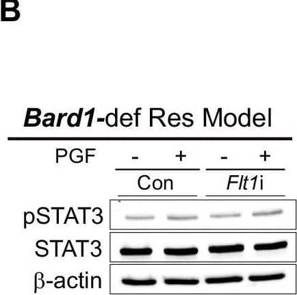 Quantitation of phosphorylated STAT3 (pSTAT3) levels in Brca1-def and Bard1-def breast tumor cells and tumor tissue sections.(A, B) Immunoblot analysis was performed using antibodies against pSTAT3, STAT3 and  beta -actin (loading control) using lysates from Flt1-expressing (Con) and -deficient (Flt1i), talazoparib-resistant (“Res”) Brca1 and Bard1-def tumor cells, treated with 50 ng/mL of mouse PGF protein that were used in Fig. 5A, B. (C) Representative images of IHC for pSTAT3 staining in tumor sections from the mice described in Fig. 1 comparing talazoparib-sensitive (“Sen”) tumors to talazoparib-resistant (“Res”) tumors. Scale bars, 20 µm. (D) Immunostained sections from (C) were quantified using automated QuPath software to identify positively stained cells. For the Brca1-def model, n = 4 tumors for both Sen and Res. For the Bard1-def model, n = 5 Sen tumors, and n = 4 Res tumors. Data were presented as mean values ± SEM. P values were determined by a two-tailed, unpaired, Mann–Whitney test. ns; not significant. Image collected and cropped by CiteAb from the following open publication (//pubmed.ncbi.nlm.nih.gov/38956205), licensed under a CC-BY license. Not internally tested by R&D Systems.