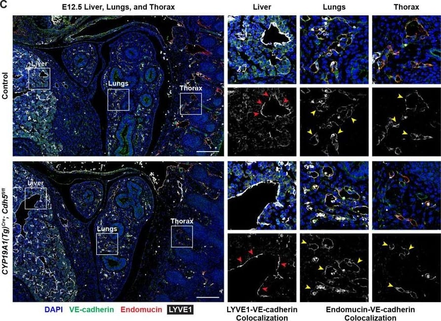 VE-cadherin expression is retained in the vasculature of affected organs in CYP19A1(Tg)Cre; Cdh5fl/fl embryos.(A) Immunofluorescence staining of E12.5 Control and CYP19A1(Tg)Cre; Cdh5fl/fl brains for VE-cadherin (green) and Endomucin (red) at sites of hemorrhage. Images in gray scale are VE-cadherin alone. Red arrowheads point to extravascular autofluorescent erythrocytes. Yellow arrowheads point to VE-cadherin+ vessels. Scale bars = 50 μm. (B) Immunofluorescence staining of E12.5 Control and CYP19A1(Tg)Cre; Cdh5fl/fl hearts for VE-cadherin (green) and Endomucin (red). Images in gray scale are VE-cadherin alone. Red arrowheads point to VE-cadherin+ developing coronary vessels. Yellow arrowheads point to VE-cadherin+ endocardium. Scale bars = 50 μm. (C) Immunofluorescence staining of E12.5 Control and CYP19A1(Tg)Cre; Cdh5fl/fl hearts for VE-cadherin (green), Endomucin (red), and LYVE1 (gray). Images in gray scale represent VE-cadherin pixels colocalized with either LYVE1 (liver) or Endomucin (lungs and thorax). Red arrowheads point to LYVE1+VE-cadherin+ liver sinusoidal vessels. Yellow arrowheads point to Endomucin+VE-cadherin+ lung and thoracic blood vessels. Scale bars = 200 μm. (D) Quantification of fold change in VE-cadherin mean fluorescence intensity in the brain, heart, liver, lungs, and thorax.Figure 1—figure supplement 3—source data 1.Excel file containing quantification for VE-cadherin expression in various organs in Figure 1—figure supplement 3.Excel file containing quantification for VE-cadherin expression in various organs in Figure 1—figure supplement 3. Image collected and cropped by CiteAb from the following open publication (//pubmed.ncbi.nlm.nih.gov/35486098), licensed under a CC-BY license. Not internally tested by R&D Systems.