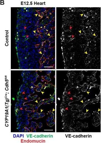 VE-cadherin expression is retained in the vasculature of affected organs in CYP19A1(Tg)Cre; Cdh5fl/fl embryos.(A) Immunofluorescence staining of E12.5 Control and CYP19A1(Tg)Cre; Cdh5fl/fl brains for VE-cadherin (green) and Endomucin (red) at sites of hemorrhage. Images in gray scale are VE-cadherin alone. Red arrowheads point to extravascular autofluorescent erythrocytes. Yellow arrowheads point to VE-cadherin+ vessels. Scale bars = 50 μm. (B) Immunofluorescence staining of E12.5 Control and CYP19A1(Tg)Cre; Cdh5fl/fl hearts for VE-cadherin (green) and Endomucin (red). Images in gray scale are VE-cadherin alone. Red arrowheads point to VE-cadherin+ developing coronary vessels. Yellow arrowheads point to VE-cadherin+ endocardium. Scale bars = 50 μm. (C) Immunofluorescence staining of E12.5 Control and CYP19A1(Tg)Cre; Cdh5fl/fl hearts for VE-cadherin (green), Endomucin (red), and LYVE1 (gray). Images in gray scale represent VE-cadherin pixels colocalized with either LYVE1 (liver) or Endomucin (lungs and thorax). Red arrowheads point to LYVE1+VE-cadherin+ liver sinusoidal vessels. Yellow arrowheads point to Endomucin+VE-cadherin+ lung and thoracic blood vessels. Scale bars = 200 μm. (D) Quantification of fold change in VE-cadherin mean fluorescence intensity in the brain, heart, liver, lungs, and thorax.Figure 1—figure supplement 3—source data 1.Excel file containing quantification for VE-cadherin expression in various organs in Figure 1—figure supplement 3.Excel file containing quantification for VE-cadherin expression in various organs in Figure 1—figure supplement 3. Image collected and cropped by CiteAb from the following open publication (//pubmed.ncbi.nlm.nih.gov/35486098), licensed under a CC-BY license. Not internally tested by R&D Systems.