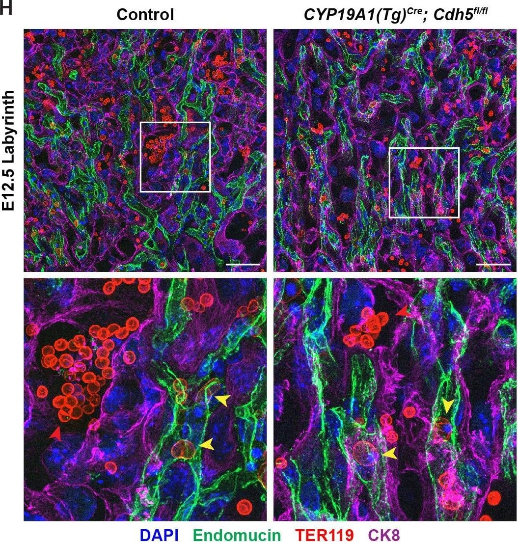 VE-cadherin is required in trophoblasts to remodel spiral arteries (SAs)&to displace SA endothelium. (G, H) Maximum intensity projections of whole-mount immunofluorescence of the decidua (G)&labyrinth (H) from 200 μm thick placenta sections stained for Endomucin (green), TER119 (red),&CK8 (magenta). Double-headed arrows indicate differences in lumen size. White arrowheads indicate Endomucin+ SA ECs. Red arrowheads indicate maternal red blood cells within the trophoblast-lined vessels. Yellow arrowheads indicate fetal red blood cells within fetal capillaries. Dotted white line demarcates the decidua from the junctional zone. Scale bars = 50 μm. Statistical analysis was performed using two-tailed, unpaired Welch’s t-test. Data are shown as means ± SD.Figure 2—source data 1.Excel file containing quantification for smooth muscle cells per spiral artery, spiral artery diameter,&trophoblast-endothelial cell displacement in Figure 2.Excel file containing quantification for smooth muscle cells per spiral artery, spiral artery diameter,&trophoblast-endothelial cell displacement in Figure 2. Image collected & cropped by CiteAb from the following open publication (//pubmed.ncbi.nlm.nih.gov/35486098), licensed under a CC-BY license. Not internally tested by R&D Systems.