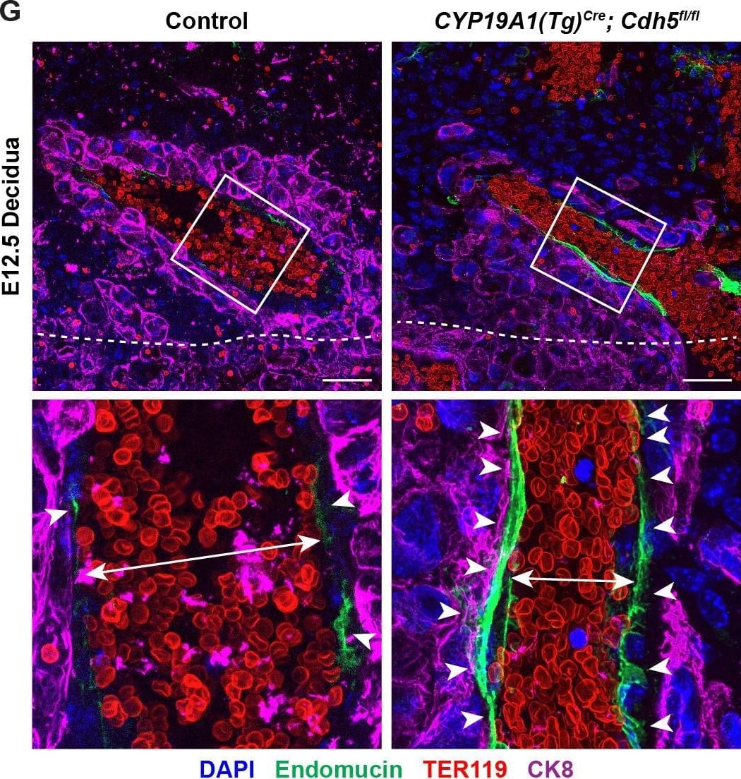 VE-cadherin is required in trophoblasts to remodel spiral arteries (SAs)&to displace SA endothelium. (G, H) Maximum intensity projections of whole-mount immunofluorescence of the decidua (G)&labyrinth (H) from 200 μm thick placenta sections stained for Endomucin (green), TER119 (red),&CK8 (magenta). Double-headed arrows indicate differences in lumen size. White arrowheads indicate Endomucin+ SA ECs. Red arrowheads indicate maternal red blood cells within the trophoblast-lined vessels. Yellow arrowheads indicate fetal red blood cells within fetal capillaries. Dotted white line demarcates the decidua from the junctional zone. Scale bars = 50 μm. Statistical analysis was performed using two-tailed, unpaired Welch’s t-test. Data are shown as means ± SD.Figure 2—source data 1.Excel file containing quantification for smooth muscle cells per spiral artery, spiral artery diameter,&trophoblast-endothelial cell displacement in Figure 2.Excel file containing quantification for smooth muscle cells per spiral artery, spiral artery diameter,&trophoblast-endothelial cell displacement in Figure 2. Image collected & cropped by CiteAb from the following open publication (//pubmed.ncbi.nlm.nih.gov/35486098), licensed under a CC-BY license. Not internally tested by R&D Systems.