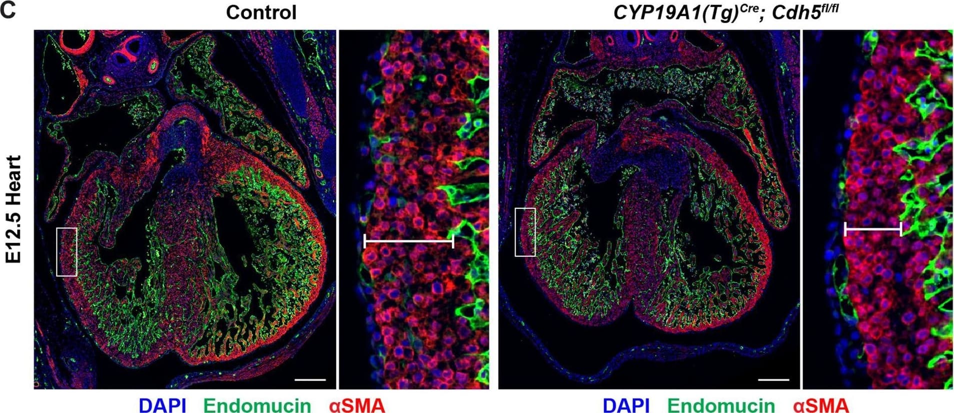 Loss of trophoblast VE-cadherin causes defects in brain, liver, and heart development.(A) Sagittal hematoxylin and eosin (H&E) sections from E12.5 Control and CYP19A1(Tg)Cre; Cdh5fl/fl embryos. Boxes show magnified regions of the brain, heart, and liver. Note the thinness of the myocardium in CYP19A1(Tg)Cre; Cdh5fl/fl embryos. Dotted red line outlines the liver contour. Green arrowhead points to tissue degradation in the brains of CYP19A1(Tg)Cre; Cdh5fl/fl embryos. (B) Quantification of the liver area as a percent of total embryo area. Control n = 4, CYP19A1(Tg)Cre; Cdh5fl/fl n = 3. (C, D) Immunofluorescence staining of E12.5 Control and CYP19A1(Tg)Cre; Cdh5fl/fl embryonic hearts for Endomucin (green) and alpha-smooth muscle actin ( alpha SMA) (red). Insets demonstrate myocardial thinning and quantified in (D). Control n = 11, CYP19A1(Tg)Cre; Cdh5fl/fl n = 5. Scale bars = 200 μm. Statistical analysis was performed using two-tailed, unpaired Welch’s t-test. Data are shown as means ± SD.Figure 1—figure supplement 2—source data 1.Excel file containing quantification for liver area and myocardial thickness in Figure 1—figure supplement 2.Excel file containing quantification for liver area and myocardial thickness in Figure 1—figure supplement 2. Image collected and cropped by CiteAb from the following open publication (//pubmed.ncbi.nlm.nih.gov/35486098), licensed under a CC-BY license. Not internally tested by R&D Systems.