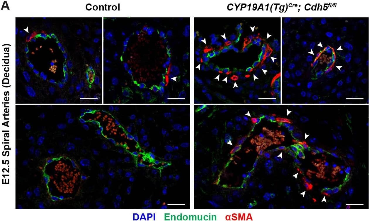 VE-cadherin is required in trophoblasts to remodel spiral arteries (SAs)&to displace SA endothelium.(A) Immunofluorescence staining of E12.5 Control&CYP19A1(Tg)Cre; Cdh5fl/fl placentas for Endomucin (green)&alpha-smooth muscle actin ( alpha SMA) (red). White arrowheads indicate  alpha SMA+ cells. Scale bars = 25 μm. Image collected & cropped by CiteAb from the following open publication (//pubmed.ncbi.nlm.nih.gov/35486098), licensed under a CC-BY license. Not internally tested by R&D Systems.