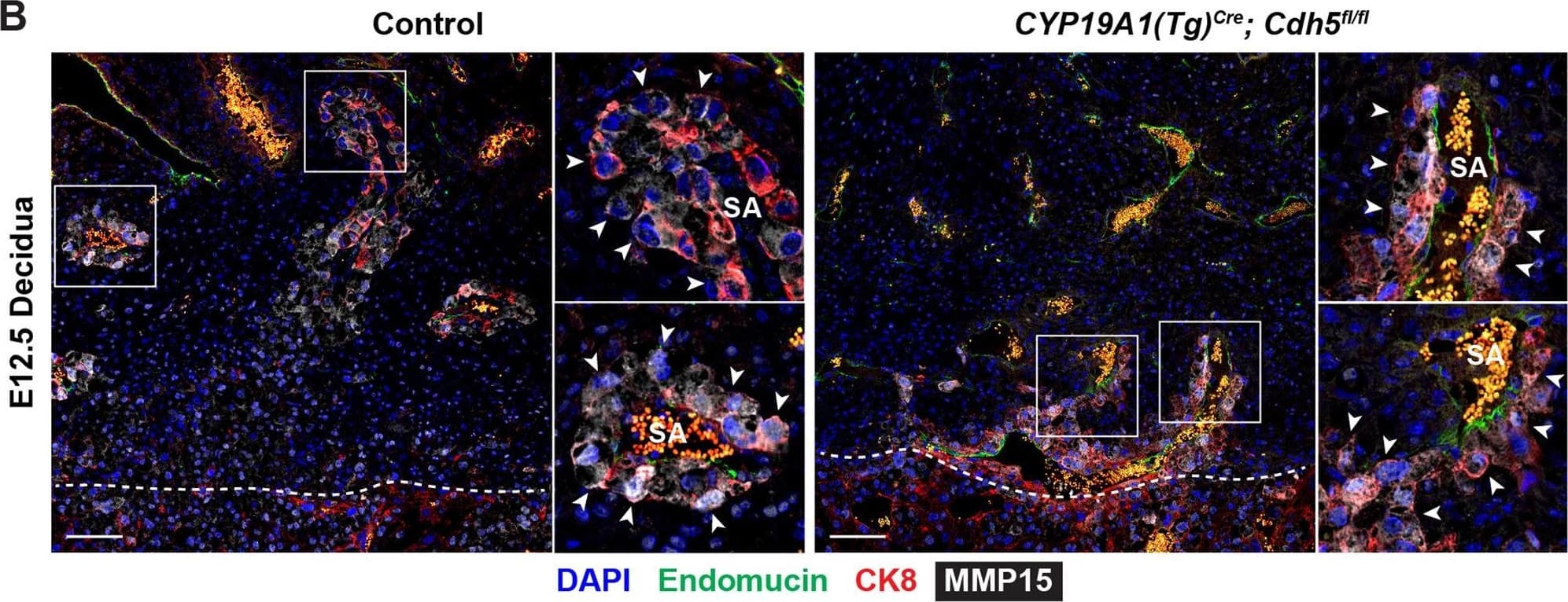 Disrupting trophoblast migration results in decidual extracellular matrix defects.(A) Mmp15 mRNA gene expression in control and CYP19A1(Tg)Cre; Cdh5fl/fl placentas from RNA-sequencing (RNA-seq). (B) Immunofluorescence staining for Endomucin (green), CK8 (red), and MMP15 (gray) in E12.5 Control and CYP19A1(Tg)Cre; Cdh5fl/fl placentas. White arrowheads point to MMP15+CK8+ trophoblasts which are more abundant in control placentas relative compared to CYP19A1(Tg)Cre; Cdh5fl/fl placentas, particularly around spiral arteries (SA), but there is no difference in MMP15 intensity in trophoblasts. Dotted line demarcates the border of the junctional zone and decidua. Positive yellow signal in small, rounded cells in the SA lumen is the result of erythrocyte autofluorescence. Scale bars = 100 μm. (C) Immunofluorescence staining for laminin (red) and CK8 (green) and quantification of fold change in laminin mean fluorescence intensity in the stroma. In control placentas, laminin is expressed in trophoblasts surrounding SAs but absent in stromal cells compared to CYP19A1(Tg)Cre; Cdh5fl/fl placentas. Scale bars = 50 μm. (D) Immunofluorescence staining for CK8 (green), vinculin (red), and TER119 (gray) and quantification of fold change in vinculin mean fluorescence intensity in trophoblasts. Scale bars = 25 μm. Statistical analysis was performed using two-tailed, unpaired Welch’s t-test. Data are shown as means ± SD.Figure 4—figure supplement 1—source data 1.Excel file containing quantification for Mmp15 gene expression, laminin expression in the decidua, and vinculin expression in trophoblasts in Figure 4—figure supplement 1.Excel file containing quantification for Mmp15 gene expression, laminin expression in the decidua, and vinculin expression in trophoblasts in Figure 4—figure supplement 1. Image collected and cropped by CiteAb from the following open publication (//pubmed.ncbi.nlm.nih.gov/35486098), licensed under a CC-BY license. Not internally tested by R&D Systems.