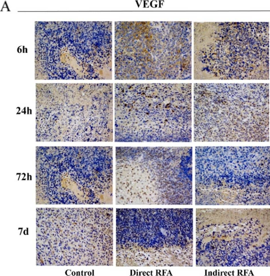 Immunohistochemistry VEGF-D Antibody [Unconjugated]