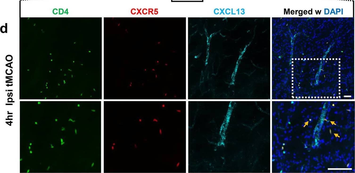Increased expression of CXCL13 on ICAM-1+ cerebral blood vessels leads to accelerated CD4 + CXCR5 + cell infiltration in the ipsilateral brain hemisphere after tMCAO. a Representative images of immunohistochemistry (IHC) staining of mouse brains with anti-ICAM-1 (green), and anti-CXCL13 (red) antibodies, and merged image (right panel) of cerebral blood vessels in ipsilateral brain hemisphere following SHAM conditions, as well as at 4 h and 24 h post-tMCAO. b Quantification of ICAM-1+ area in ipsilateral brain hemisphere following SHAM conditions, as well as at 4 h and 24 h post-tMCAO (n = 5). c Quantification of percentage area of ICAM-1+ vessels that are also CXCL13+ in ipsilateral brain hemisphere following SHAM conditions, at 4 h post-tMCAO and at 24 h post-MCAO in mice (n = 5). d Representative low (top panels) and high (bottom panels) magnification images of CD4 (green), CXCR5 (red), and CXCL13 (cyan) IHC staining at the peri-infarct area, 4 h post-tMCAO. Bottom panels are a higher magnification image of the dotted box from the top panel to highlight double-positive CD4+ CXCR5+ T cells indicated by orange arrows. Scale bar = 30 μm. e–g Quantification of CD4+ T cells (e), percentage of CD4+ T cells positive for CXCR5 (f), and percentage of CXCR5+ cells positive for CD4 (g) in the contralateral caudate, ipsilateral caudate/thalamus and ipsilateral cortex. Data are combined from three independent experiments. Data represent mean ± s.e.m. *P < 0.05, **P < 0.01, ***P < 0.001, ****P < 0.0001. n.s. = not significant. One-way ANOVA followed by Dunn’s post hoc test (b, c, e, f, g) Image collected and cropped by CiteAb from the following open publication (//pubmed.ncbi.nlm.nih.gov/35624463), licensed under a CC-BY license. Not internally tested by R&D Systems.