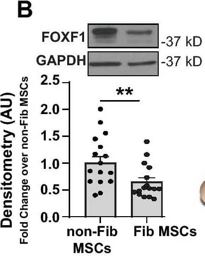 Loss of FOXF1 promotes fundamental cellular processes in LR-MSCs. (A) mRNA was isolated from fibrotic and non-fibrotic LR-MSCs derived from bronchoalveolar lavage fluid of transplant patients, and FOXF1 expression was analyzed by real-time PCR. Values: Means ± SEM; n = 9 (non-Fib-MSCs); n = 8 (Fib-MSCs); **p < 0.0034. (B) Protein lysates from fibrotic and non-fibrotic LR-MSCs were analyzed for FOXF1 and GAPDH by western blotting. Graph shows densitometry analyses of these immunoblots. Values: Means ± SEM; n = 16; **p < 0.0086. (C) LR-MSCs were transfected with scrambled or FOXF1-specific siRNA and confirmed by real-time PCR. Values: Means ± SEM; n = 7; ***p < 0.0005. (D) Protein lysates from (A) were subjected to immunoblotting with antibodies against FOXF1 and GAPDH. (E–I) Gene regulation due to FOXF1 silencing was analyzed by Affymetrix gene array in 3 lines of LR-MSCs. Data reflects fold changes ≥ 1.5, and an adjusted p < 0.01. (E) Diagram showing the number of upregulated and downregulated genes. (F) Gene–gene interaction network (using STRING database) showing associations due to FOXF1-silencing. (G–I) Heatmaps showing two-fold Log changes are presented for positive regulation of cell cycle ((G) GO:0045787), inflammatory response ((H) GO:0006954), and regulation of cell migration ((I) GO:0030334). Note: Full length blots for Fig. 1B and Fig. 1D are provided in Supplementary Fig. S1 and S2. Image collected and cropped by CiteAb from the following publication (//pubmed.ncbi.nlm.nih.gov/33277571), licensed under a CC-BY license. Not internally tested by R&D Systems.