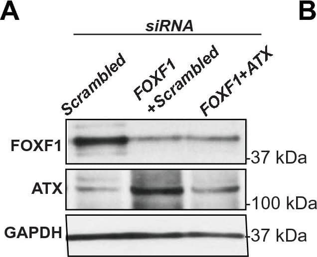 ATX-dependent cell migration in FOXF1-silenced LR-MSCs. (A) LR-MSCs were transfected with scrambled or FOXF1-specific siRNA. 24 h later, these LR-MSCs were transfected with scrambled or ATX-specific siRNA. Immunoblotting was performed to confirm RNAi-mediated FOXF1 and ATX silencing efficacy. n = 5 per group. (B) Migration assay was conducted in LR-MSCs transfected with scrambled or siRNA specific to FOXF1, ATX, or both FOXF1- and ATX-specific siRNA. Representative images of cell migration are shown. (C) Quantification of (B), n = 5, ***p < 0.0003. (D) LR-MSCs transfected with scrambled or FOXF1-specific siRNA were treated with the ATX inhibitor, PF-8380 (1 μM) and migration assay was performed. Values: Means ± SEM. n = 5, **p < 0.0142, *p < 0.0325. (E,F) Migration assays are shown with LR-MSCs transfected with scrambled or FOXF1-specific siRNA, and then treated with the LPA1 inihibitor, VPC12249 (1 μM) (E), or subjected to lentivirus-mediated shRNA interference against LPAR1 (F). Values: Means ± SEM. n = 5. ***p < 0.0002, ****p < 0.0001. Note: Full length blots for Fig. 3A are provided in Supplementary Fig. S5. Image collected and cropped by CiteAb from the following publication (//pubmed.ncbi.nlm.nih.gov/33277571), licensed under a CC-BY license. Not internally tested by R&D Systems.