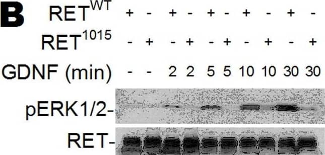 GDNF-induced Ca2+ signaling phosphorylates ERK1/2 and CaMKII.(A–D) Western blot of HeLa cells transfected with RETWT or RET1015 treated with GDNF (100 ng/ml). GDNF triggers time dependent phosphorylation of ERK1/2 (pERK1/2) in RETWT cells that is suppressed by BAPTA (10 µM) (A). Less pERK1/2 is observed in cells transfected with RET1015 than RETWT (B). GDNF-induced phosphorylation of CaMKII (pCaMKII) or pERK1/2 is suppressed when blocking PLC with U73122 (5 µM) (C) or knocking down PLC gamma  with siRNA (PLC gamma -siRNA) (D). Treating RETWT cells with the U73122 analogue U73343 (5 µM) had no effect on GDNF-activated pCaMKII or pERK1/2 (C). Increased Caspase-3 cleavage was not detected in cells treated with the inhibitors BAPTA or U73122 (C). Image collected and cropped by CiteAb from the following open publication (//pubmed.ncbi.nlm.nih.gov/22355350), licensed under a CC-BY license. Not internally tested by R&D Systems.