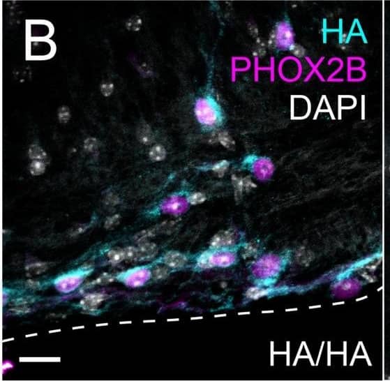 Immunohistochemistry PHOX2B Antibody [Unconjugated]