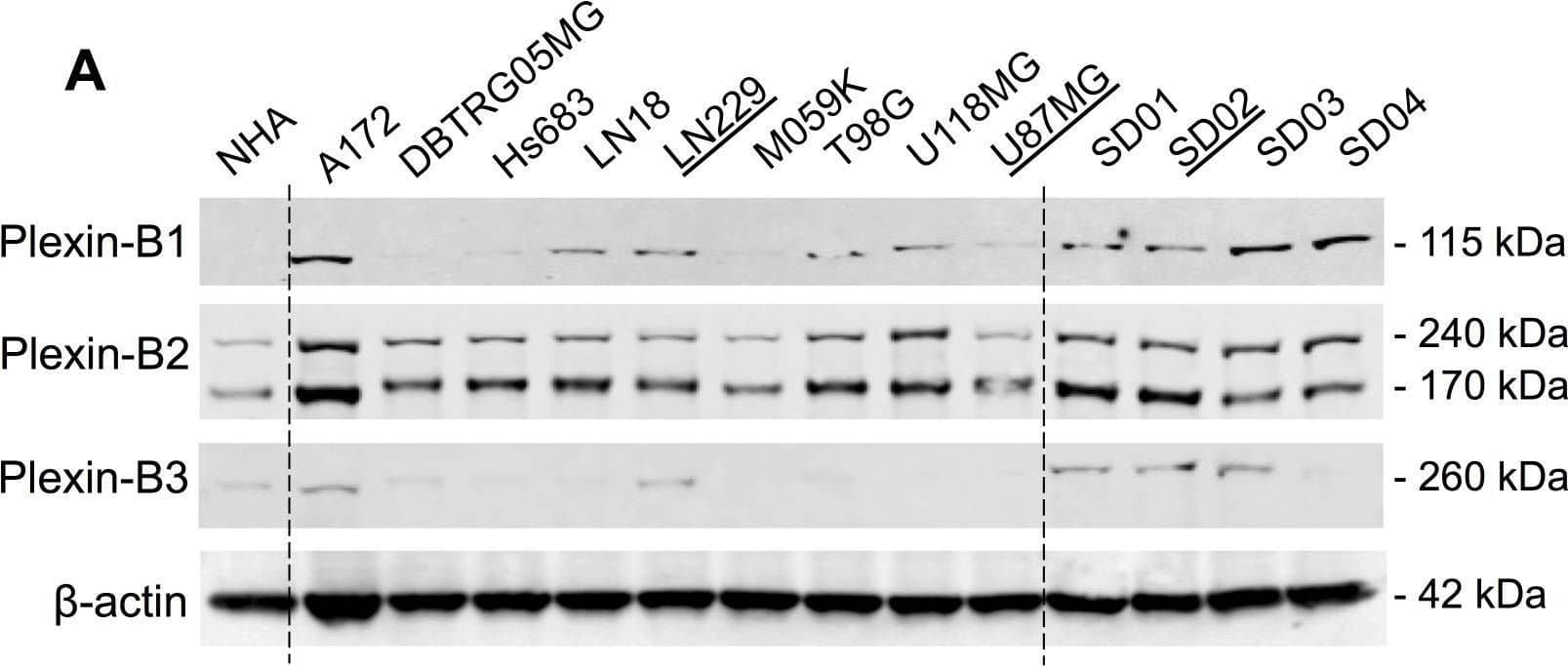 Western Blot Plexin B3 Antibody [Unconjugated]