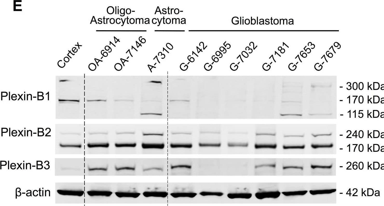 Plexin-B2 is upregulated in gliomaA) Relative Plexin-B gene expressions in glioma vs. normal brain from microarray data of four patient studies (B, Bredel et al. (n=49); S, Sun et al. (n=49); T, TCGA (n=424); R, Rembrandt (n=454)). Whiskers show top and bottom quartiles. PLXNB2 was upregulated in all four glioma studies. B) Relative PLXNB2 expression in four molecular subtypes of glioblastoma (TCGA dataset; proneural, n=113; neural, n=70; classical, n=112; mesenchymal, n=128). C) Abundance of Plexin-B and Sema4 mRNA in TCGA glioblastoma samples (n=169), shown as RSEM counts (upper quartile boundary normalized to 1000). PLXNB2 exhibited the highest mean abundance level overall, and SEMA4B, 4C and 4D exhibited higher levels than other Sema4s. D) PLXNB2 mean expression is significantly increased in all WHO glioma types (NCI/Rembrandt patient cohort; n=454; probeset 208890_s_at) and highest in glioblastoma (p<0.001). E) Western blot of nine surgical samples from glioma patients reveals robust Plexin-B2 protein expression (170 kDa band is the processed, mature form of Plexin-B2). Normal human cortex served as control. Plexin-B1 and -B3 protein are variably expressed among glioma samples. Image collected and cropped by CiteAb from the following open publication (//pubmed.ncbi.nlm.nih.gov/25762646), licensed under a CC-BY license. Not internally tested by R&D Systems.