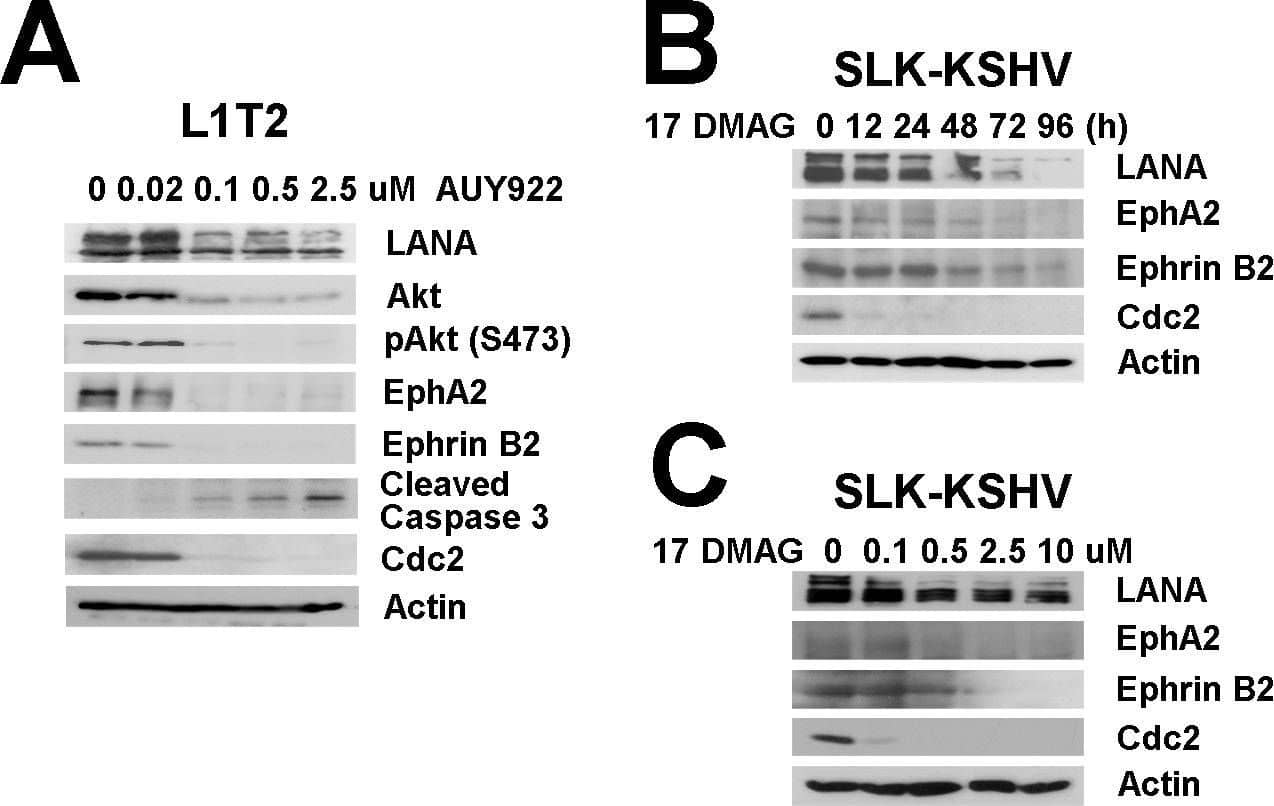 Effects of Hsp90 inhibitors on LANA in KSHV-infected endothelial cells.(A) L1T2 cells were treated with AUY922 at concentrations of 0, 0.02, 0.1, 0.5, and 2.5 µM for 48 hours, whole cell lysates were immunoblotted with anti-LANA, anti-Hsp90 antibodies, anti-EphA2, anti-Ephrin-B2, and anti-Akt (total), and anti-pAkt (S473) antibodies separately. Apoptosis was evaluated with anti-cleaved PARP and anti-cleaved Caspase-3 antibodies, Cdc2 and  beta -Actin were used as controls. (B–C) SLK-KSHV were treated with 0.5 µM 17-DMAG for 0, 12, 24, 48, 72 and 96 hours, or at concentrations of 0, 0.1, 0.5, 2.5 and 10 µM for 48 hours separately, whole cell lysates were immunoblotted with anti-LANA antibody, anti-EphA2, anti-EphrinB2, Cdc2 and  beta -Actin were used as controls. Image collected and cropped by CiteAb from the following open publication (//pubmed.ncbi.nlm.nih.gov/23209418), licensed under a CC-BY license. Not internally tested by R&D Systems.