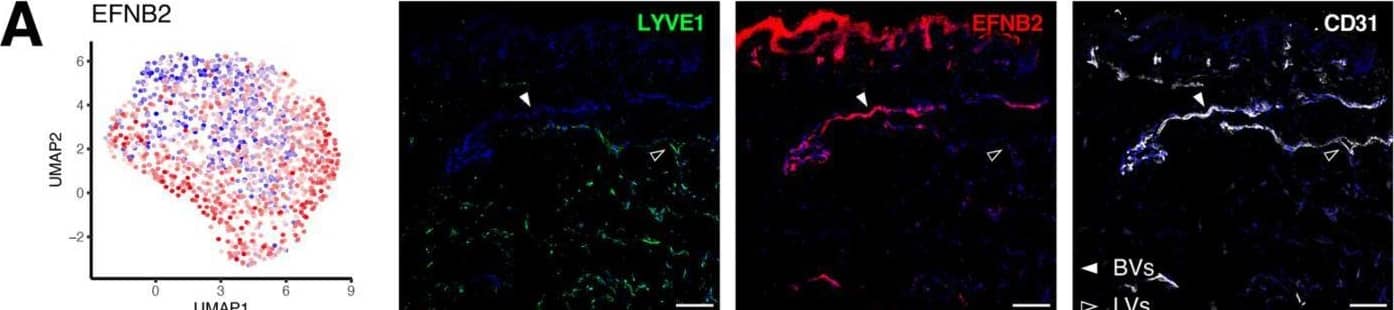 Gene signatures peculiar to the venular compartment. (A) EFNB2 expression measured by scRNA-seq (left) and immunofluorescence staining (right) denoting its abundance across different BEC subpopulations and its exclusive expression in human dermal BVs (white arrowheads). (B) Representative confocal images of skin sections (upper) and whole-mount skin blocks (lower) stained for ERG (green), EFNB2 (red) and ICAM1 (white). The unique composition of EFNB2 and ICAM1 expression enables the discrimination of arterioles (empty arrowheads), post-capillary venules (*) and venules (white arrowheads). (C) EGR2 expression is most enriched in the post-capillary venule cluster and is restricted to BVs (white arrowheads). (D) Representative section (upper) and whole-mount staining (lower) of ERG (green), EGR2 (red) and ICAM1 (white), highlighting EGR2+ICAM1+ BVs. Scale bars: 100 µm. Image collected and cropped by CiteAb from the following open publication (//pubmed.ncbi.nlm.nih.gov/35406678), licensed under a CC-BY license. Not internally tested by R&D Systems.