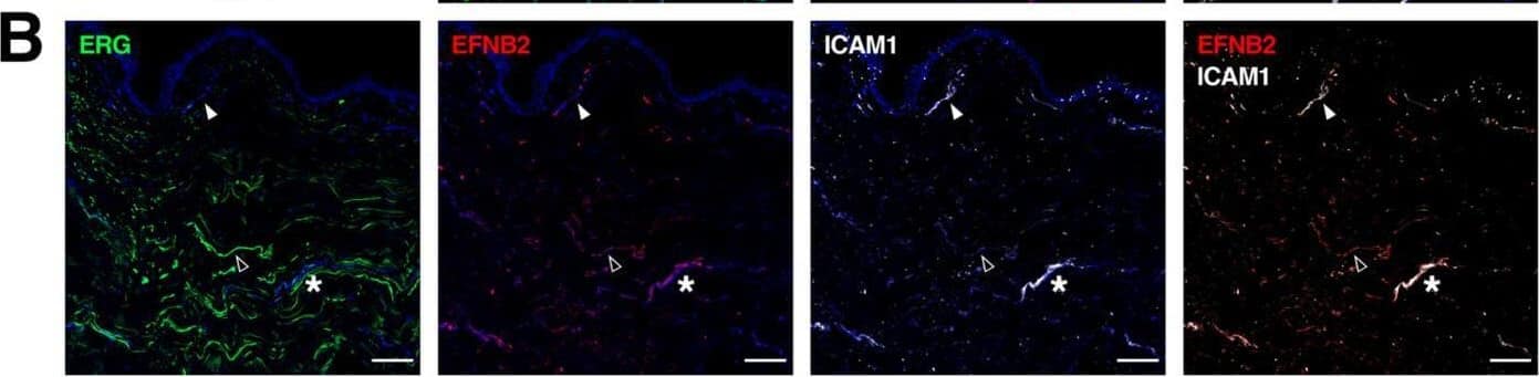 Gene signatures peculiar to the venular compartment. (A) EFNB2 expression measured by scRNA-seq (left) and immunofluorescence staining (right) denoting its abundance across different BEC subpopulations and its exclusive expression in human dermal BVs (white arrowheads). (B) Representative confocal images of skin sections (upper) and whole-mount skin blocks (lower) stained for ERG (green), EFNB2 (red) and ICAM1 (white). The unique composition of EFNB2 and ICAM1 expression enables the discrimination of arterioles (empty arrowheads), post-capillary venules (*) and venules (white arrowheads). (C) EGR2 expression is most enriched in the post-capillary venule cluster and is restricted to BVs (white arrowheads). (D) Representative section (upper) and whole-mount staining (lower) of ERG (green), EGR2 (red) and ICAM1 (white), highlighting EGR2+ICAM1+ BVs. Scale bars: 100 µm. Image collected and cropped by CiteAb from the following open publication (//pubmed.ncbi.nlm.nih.gov/35406678), licensed under a CC-BY license. Not internally tested by R&D Systems.