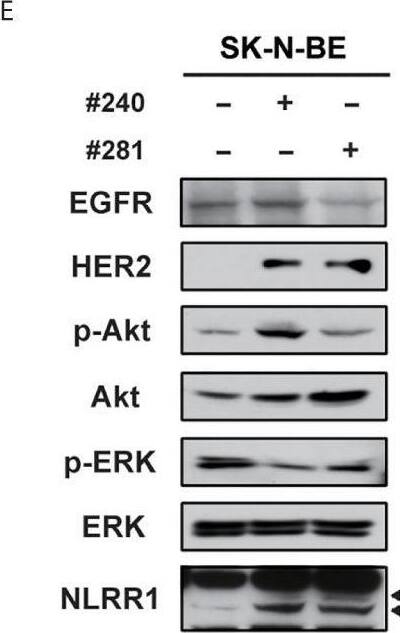 Western Blot LRRN1/NLRR-1 Antibody