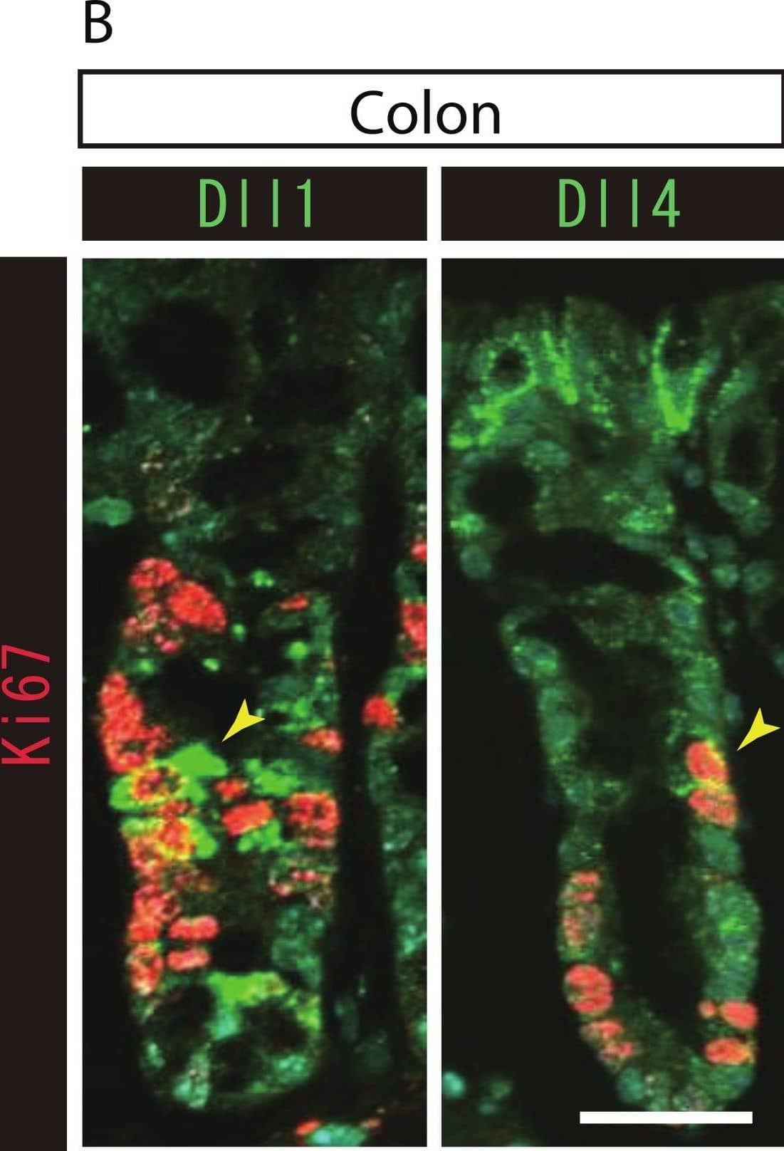 Both Dll1+ve and Dll4+ve IECs are mostly post-mitotic in the small intestine and in the colon.Double immunostaining of Dll1 or Dll4 (green) with the proliferation cell marker, Ki67 (red), shows that both Dll1+ve and Dll4+ve IECs are mostly post-mitotic in the small intestine (A) and in the colon (B). However, a small number of Dll1+ve or Dll4+ve IECs that co-express Ki67 can be found (yellow arrowhead). Scale bar represents 20 µm. These data were acquired by confocal microscopy (FV10i). Image collected and cropped by CiteAb from the following open publication (//pubmed.ncbi.nlm.nih.gov/24860699), licensed under a CC-BY license. Not internally tested by R&D Systems.