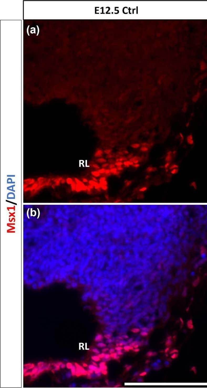 Msx1 expression in E12.5 Wls-knockout mutant and control cerebella. In control cerebellum (A,B), Msx1 is expressed in the RL. Expression of Msx1 in the RL is persisted in the Wls knockout cerebellum (C,D) and similar to Msx1 expression in the control RL. RL, rhombic lip. Scale bars, 100 μm. Image collected and cropped by CiteAb from the following open publication (//www.frontiersin.org/articles/10.3389/fnmol.2024.1356544/full), licensed under a CC-BY license. Not internally tested by R&D Systems.