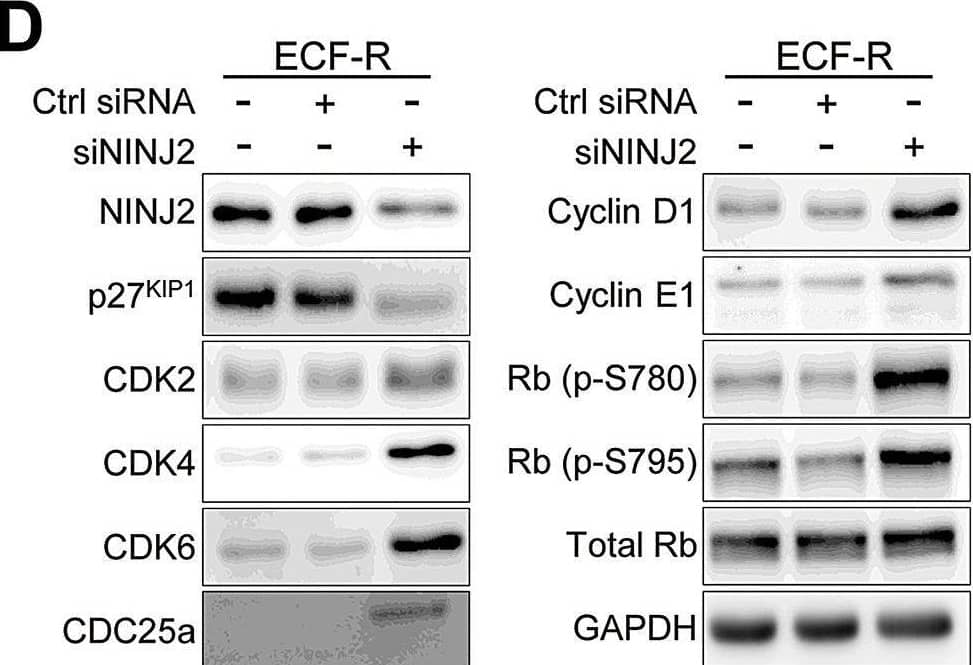 Western Blot Ninjurin-2 Antibody [Unconjugated]