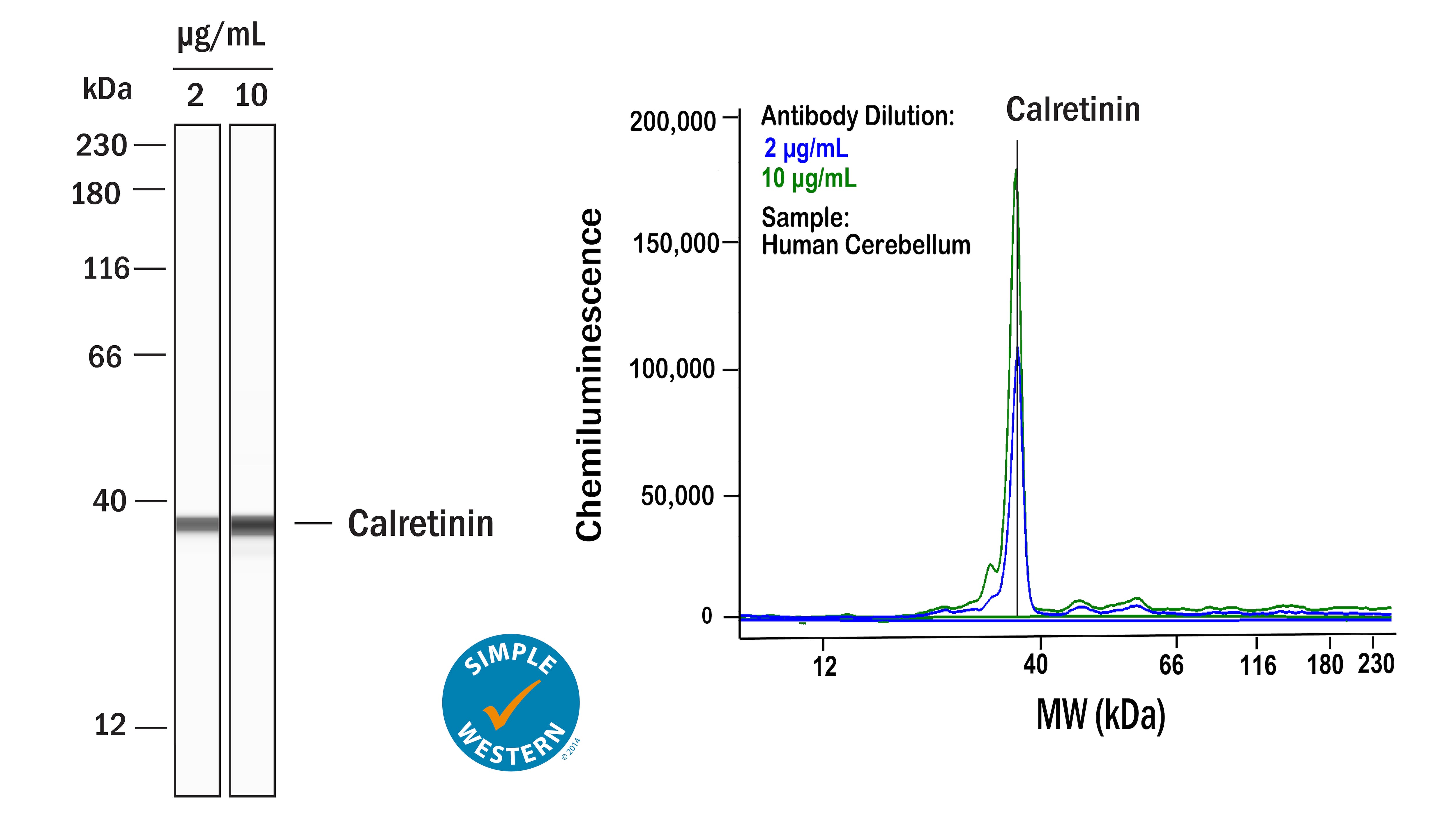 Simple Western Calretinin Antibody [Unconjugated]